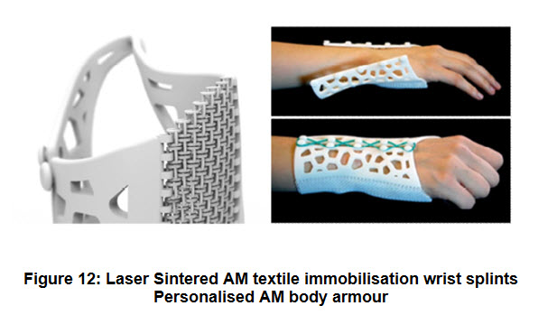 Fig 12 Splint