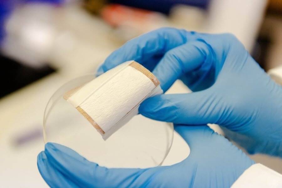Electrospun nanofibres for wound healing
